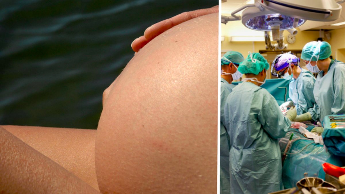 Gravid, operation